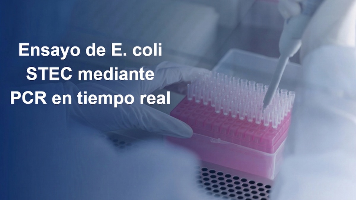 analisis-pcr-e-coli-stec-laboratorio.jpg